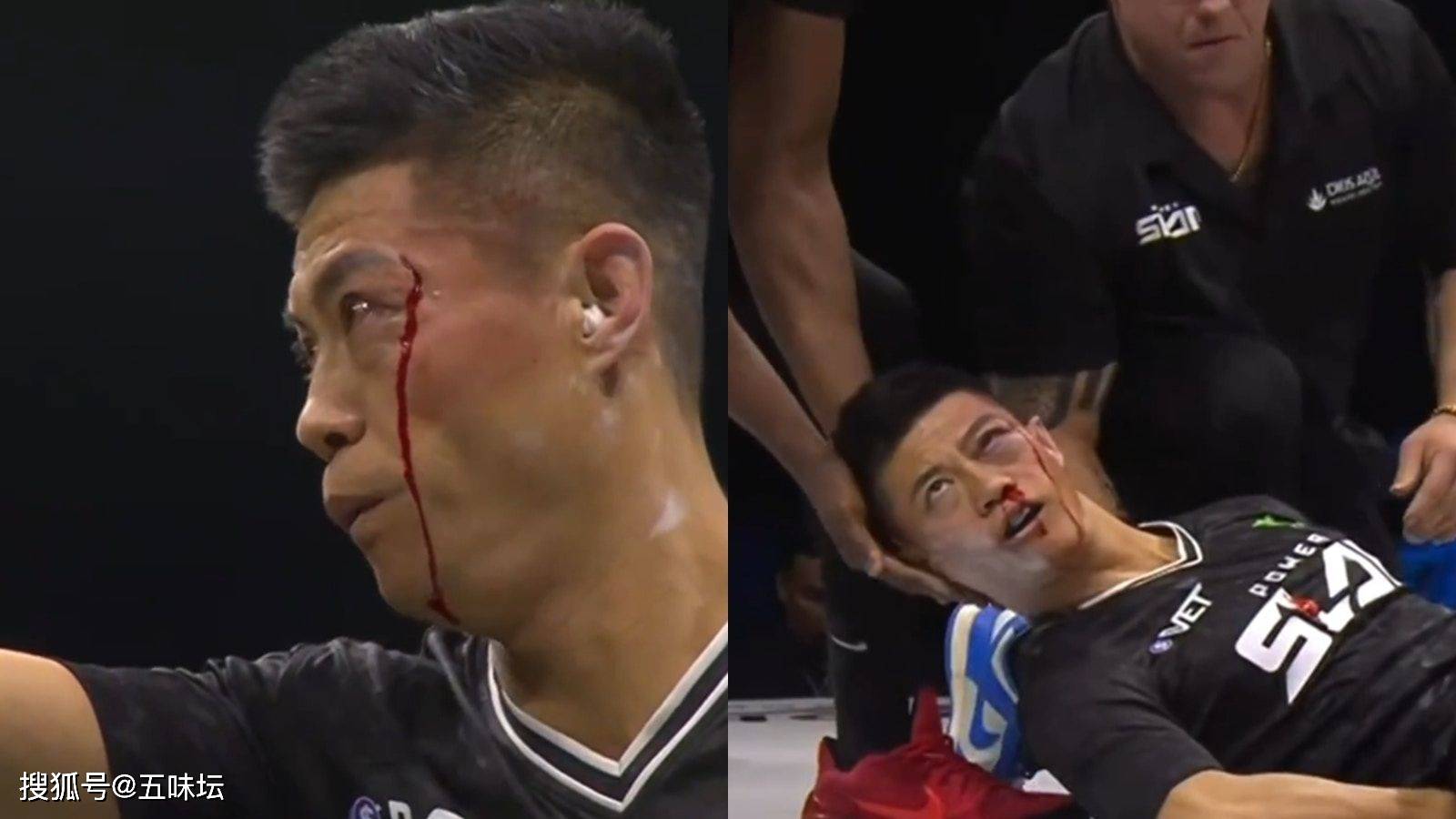 关于津门虎门将方镜淇归队5月份在比赛中遭遇重伤的信息